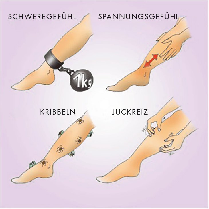 Lipödem Beschwerden